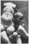 The black and white photograph from The Doll (1934) by Hans Bellmer presents a full plastered torso, a full head, wig, fragmented limbs, ball joints, a glass eye and a marble, set on top of white laced panties against the background of a striped mattress, now seen from above.