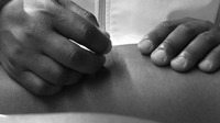 Close-up photograph of a trainer’s hands while they insert a needle into a player’s body.